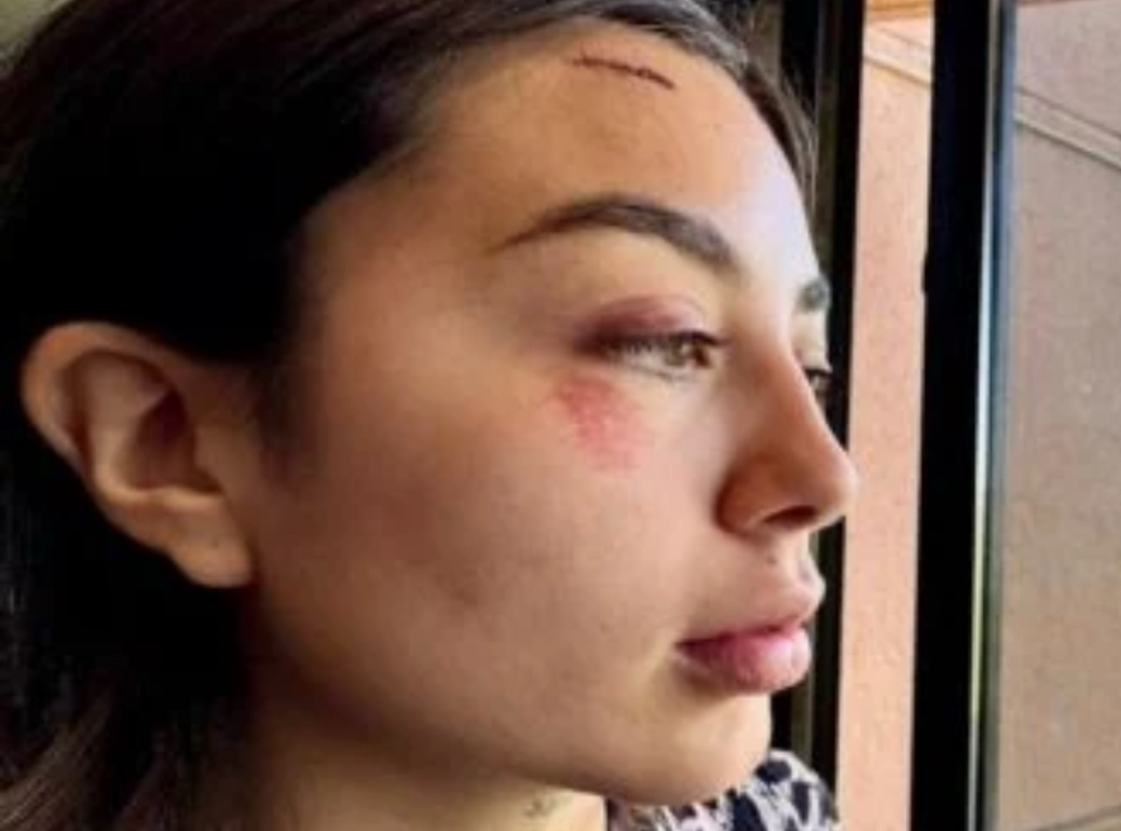 Los gorilas de la 4T la medio mataron el 15N… un juez rechaza los videos porque dice: «Pueden ser de IA»